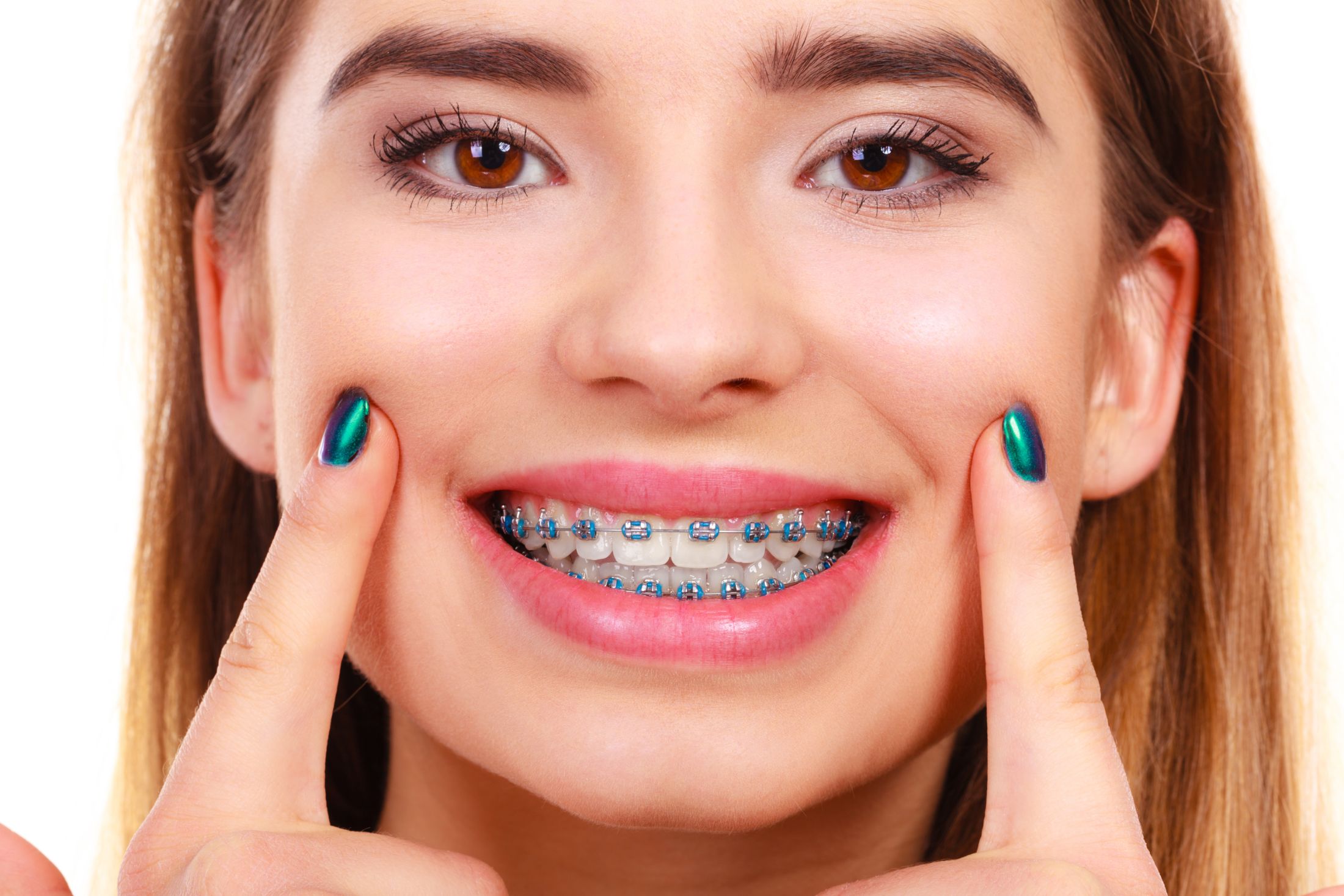 Teeth Clicking With Braces