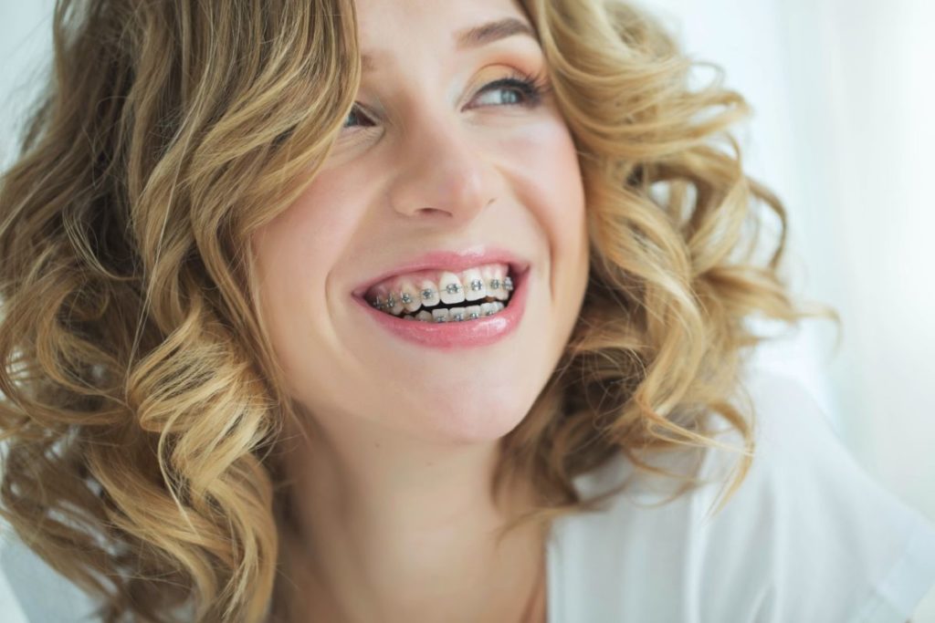 Types Of Braces