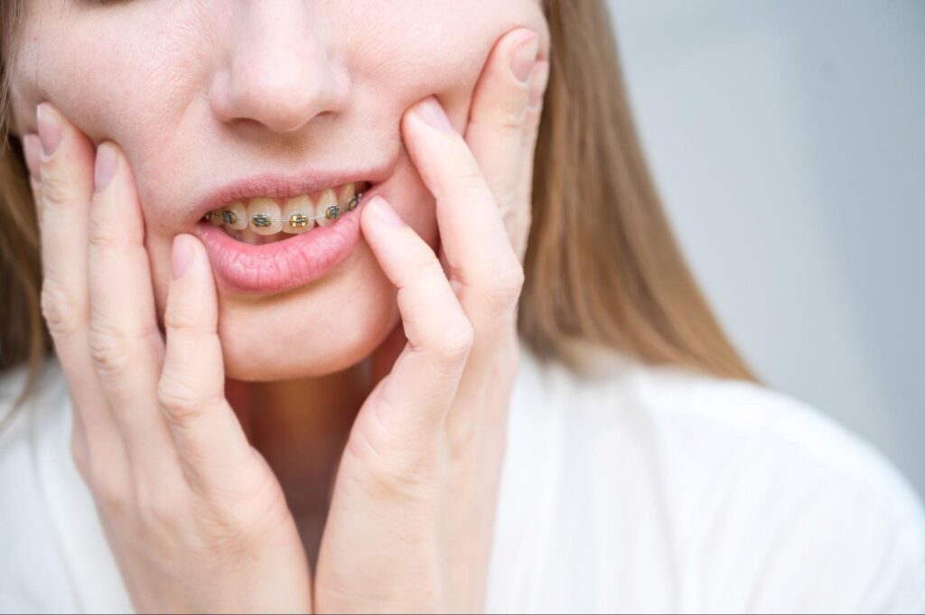 How To Stop Braces Pain After Tightening